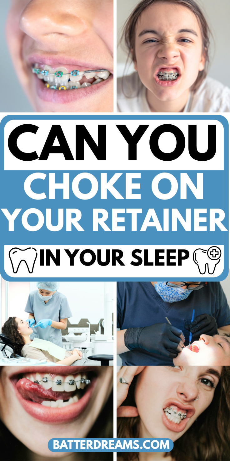 Can You Choke On Your Retainer In Your Sleep